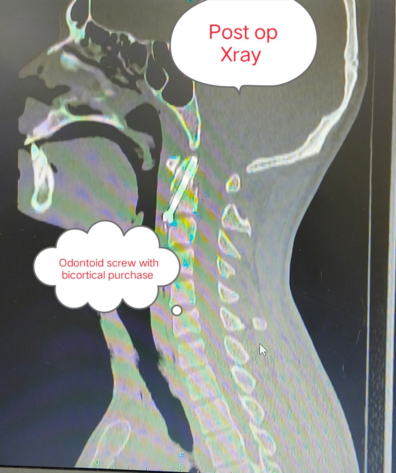 when-similar-symptoms-tell-different-stories--a-tale-of-two-patients---------thumbnail